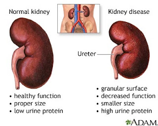 kidneys